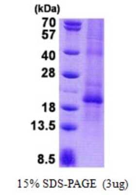 SDS-PAGE: Recombinant Human CGB2 His Protein [NBP2-22778]