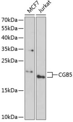 Western Blot: CGB5 AntibodyBSA Free [NBP2-92475]