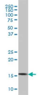 Western Blot: CGGBP1 Antibody (1D11) [H00008545-M02]