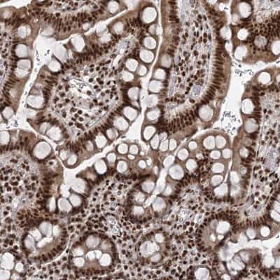 Immunohistochemistry: CGGBP1 Antibody [NBP2-32680]