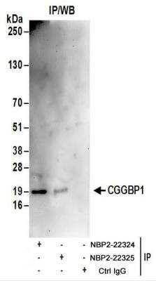 Immunoprecipitation: CGGBP1 Antibody [NBP2-22325]