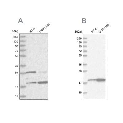 Western Blot: CGGBP1 Antibody [NBP1-84528]