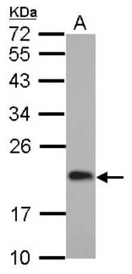 Western Blot: CGGBP1 Antibody [NBP2-15869]