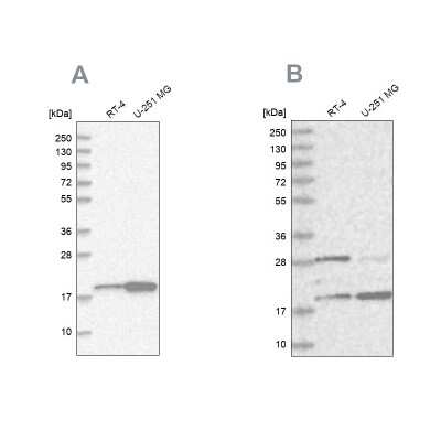 Western Blot: CGGBP1 Antibody [NBP2-32680]