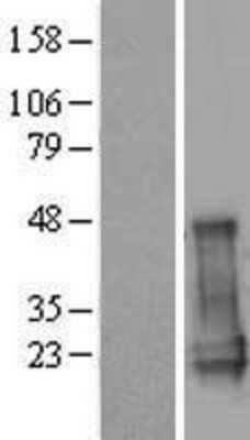 Western Blot: CGGBP1 Overexpression Lysate [NBL1-09134]