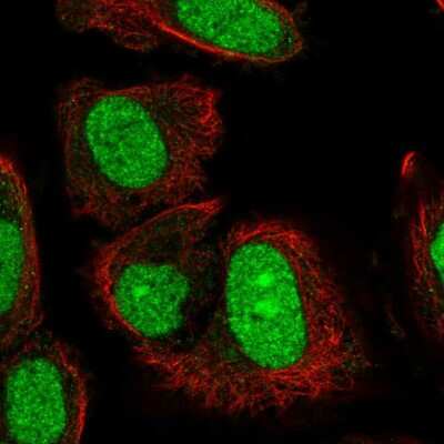 Immunocytochemistry/ Immunofluorescence: CGI-09 Antibody [NBP2-58675]