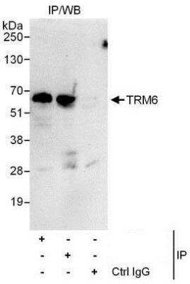 Immunoprecipitation: CGI-09 Antibody [NBP1-50039]