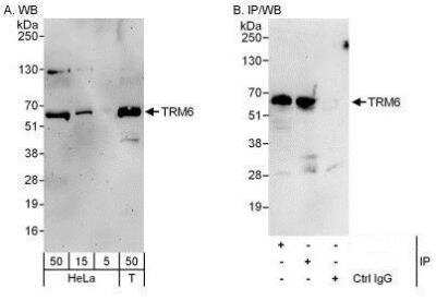 Western Blot: CGI-09 Antibody [NBP1-50040]