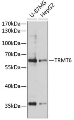 Western Blot: CGI-09 AntibodyAzide and BSA Free [NBP2-92578]