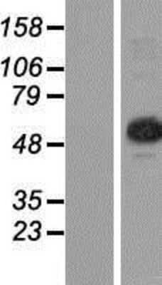 Western Blot: CGI-09 Overexpression Lysate [NBP2-07108]