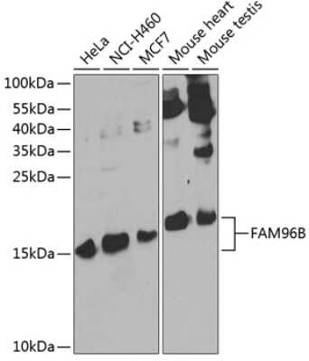 Western Blot: CGI-128 AntibodyBSA Free [NBP2-92518]