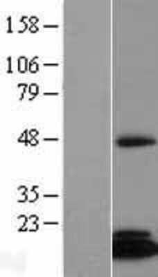 Western Blot: CGI-128 Overexpression Lysate [NBL1-10584]