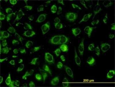 Immunocytochemistry/ Immunofluorescence: CGI-16 Antibody (4E4) [H00023597-M01]