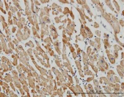 Immunohistochemistry-Paraffin: CGI-16 Antibody (4E4) [H00023597-M01]