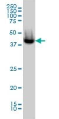 Western Blot: CGI-16 Antibody (4E4) [H00023597-M01]