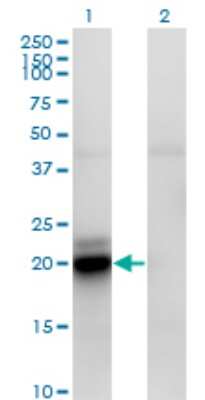 Western Blot: CGI-16 Antibody (4E4) [H00023597-M01]