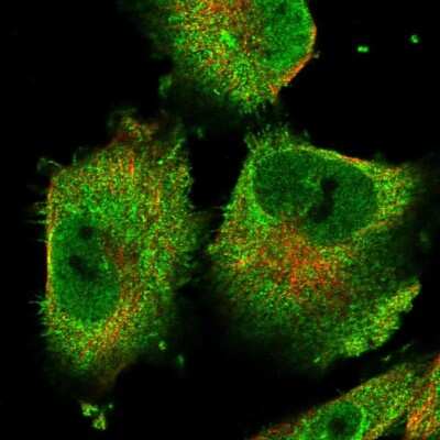 Immunocytochemistry/ Immunofluorescence: CGI-16 Antibody [NBP1-90275]
