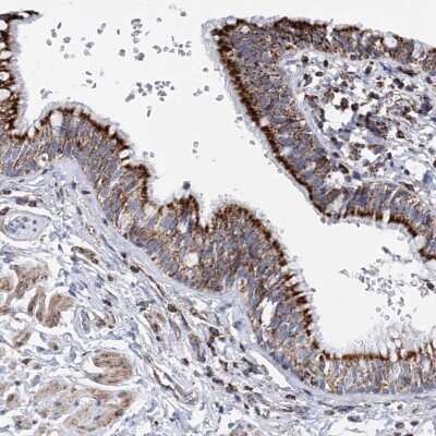 Immunohistochemistry-Paraffin: CGI-16 Antibody [NBP1-90275]