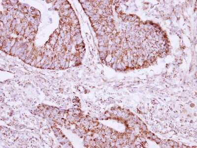 Immunohistochemistry-Paraffin: CGI-16 Antibody [NBP2-15872]