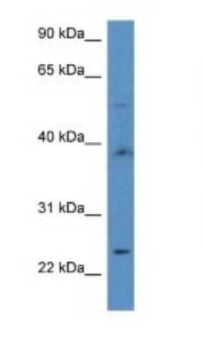 Western Blot: CGI-16 Antibody [NBP1-74084]