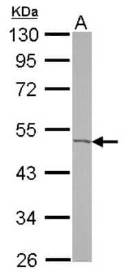 Western Blot: CGI-16 Antibody [NBP2-15872]