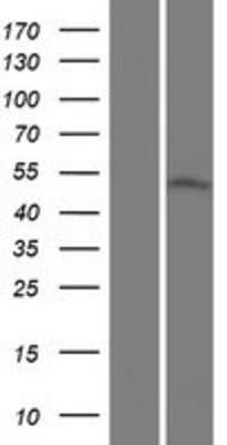 Western Blot: CGI-16 Overexpression Lysate [NBP2-10620]