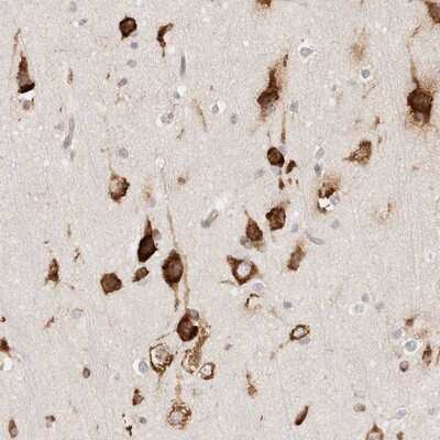 Immunohistochemistry-Paraffin: CGI 62 Antibody [NBP1-88246]