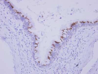 Immunohistochemistry-Paraffin: CGI 62 Antibody [NBP2-15870]