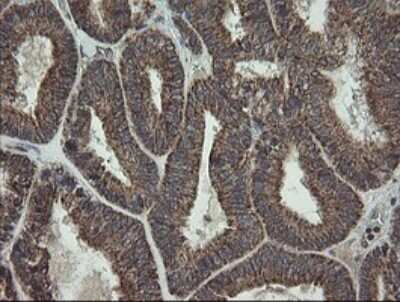 Immunohistochemistry: CGI 62 Antibody (OTI4C1) - Azide and BSA Free [NBP2-71896]