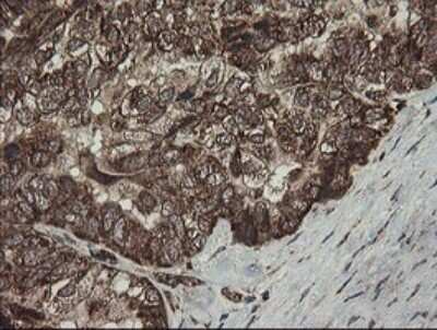 Immunohistochemistry: CGI 62 Antibody (OTI4C1) - Azide and BSA Free [NBP2-71896]
