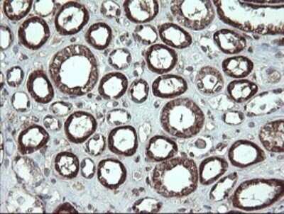 Immunohistochemistry: CGI 62 Antibody (OTI4C1) - Azide and BSA Free [NBP2-71896]