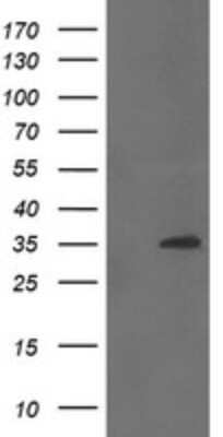 Western Blot: CGI 62 Antibody (OTI4C1)Azide and BSA Free [NBP2-71896]