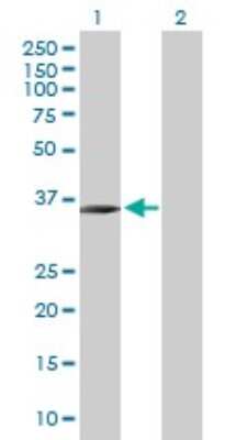 Western Blot: CGI 62 Antibody [H00051101-B01P]