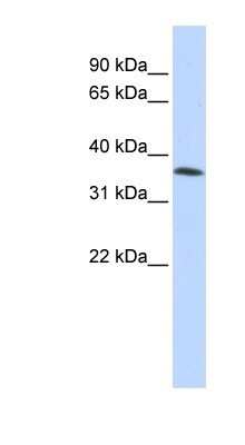 Western Blot: CGI 62 Antibody [NBP1-79991]