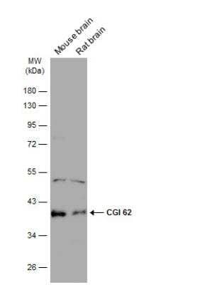 Western Blot: CGI 62 Antibody [NBP2-15870]