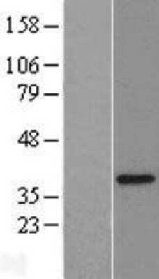 Western Blot: CGI 62 Overexpression Lysate [NBL1-10491]