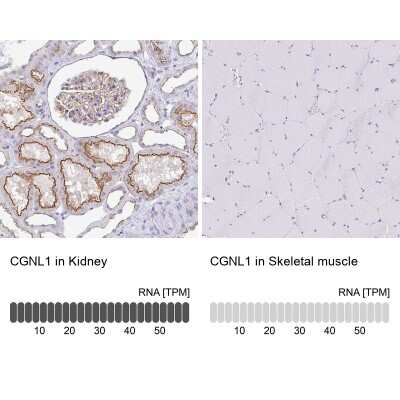 Immunohistochemistry-Paraffin: CGNL1 Antibody [NBP2-37959]