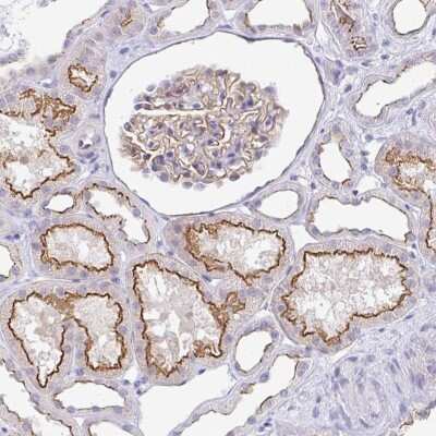 Immunohistochemistry-Paraffin: CGNL1 Antibody [NBP2-37959]