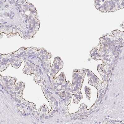 Immunohistochemistry-Paraffin: CGNL1 Antibody [NBP2-37959]