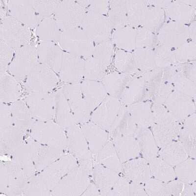 Immunohistochemistry-Paraffin: CGNL1 Antibody [NBP2-37959]