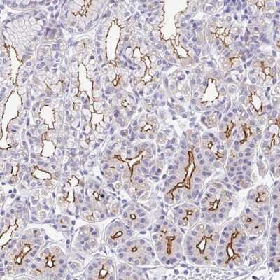 Immunohistochemistry-Paraffin: CGNL1 Antibody [NBP2-37959]