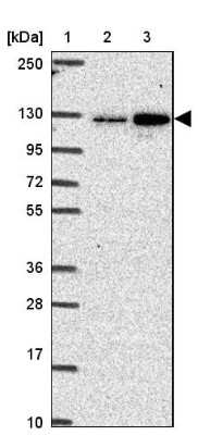 Western Blot: CGNL1 Antibody [NBP2-37959]