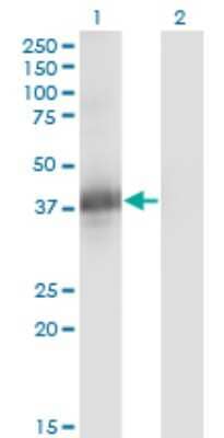 Western Blot: CGR19 Antibody (1A4) [H00010668-M04]