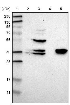 Western Blot: CGR19 Antibody [NBP1-85644]