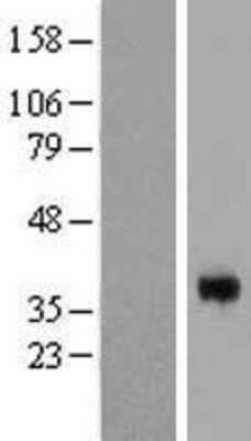 Western Blot: CGR19 Overexpression Lysate [NBL1-09137]