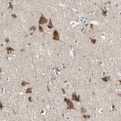 Immunohistochemistry-Paraffin: CGREF1 Antibody [NBP1-84496]