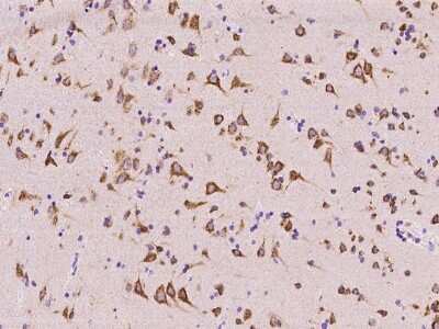 Immunohistochemistry-Paraffin: CGREF1 Antibody [NBP2-97367]