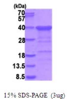 SDS-PAGE: Recombinant Human CGREF1 His Protein [NBP2-51928]