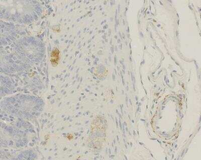 Immunohistochemistry-Paraffin: CGRP1 Antibody (4) - BSA Free [NBP3-00519]