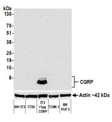 Western Blot: CGRP1 Antibody (BLR159J) [NBP3-14734]